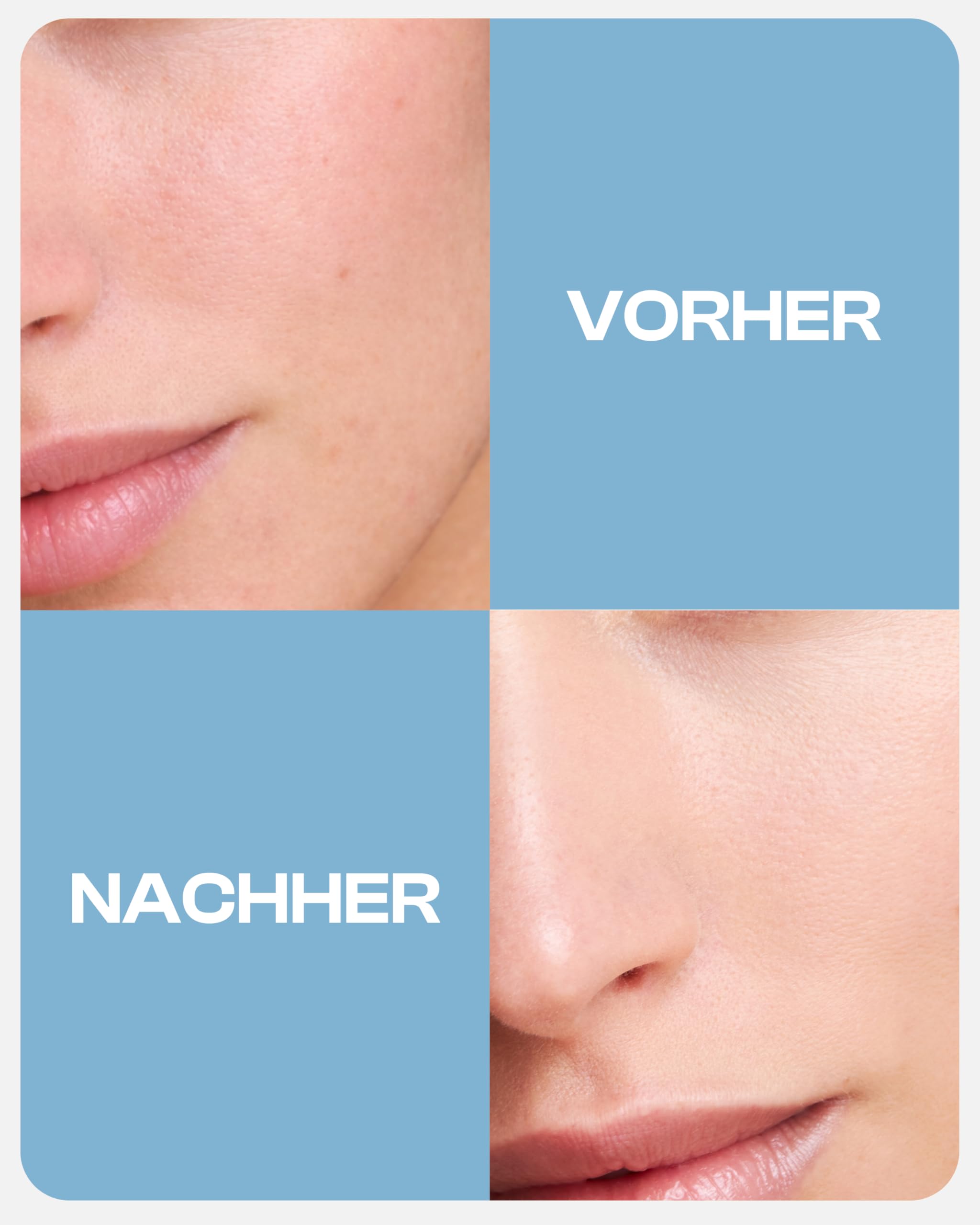 Nutraskin 4URbelly – Pflegende Bodylotion Damen für einen straffen Bauch I Straffende Körpercreme mit Mariendistel, Bärentraube & pflanzlichen Stammzellen I Damen-Körperpflege Made in Germany I 100ml