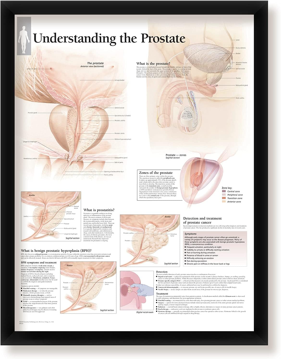 Set of 3 Framed Medical Posters Male Reproductive System Understanding The Prostate and Understanding Prostate Cancer 22"x28" Wall Diagrams