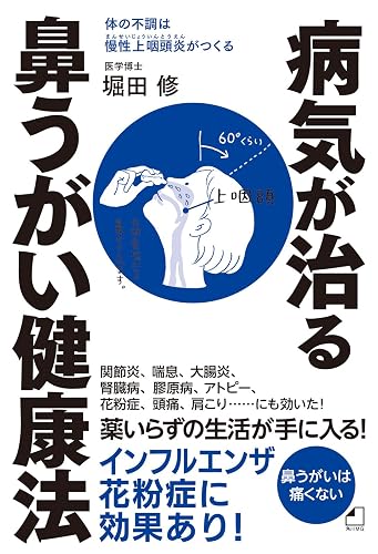 よくわかる最新療法 病気が治る鼻うがい健康法 体の不調は慢性上咽頭炎がつくる (角川マガジンズ)