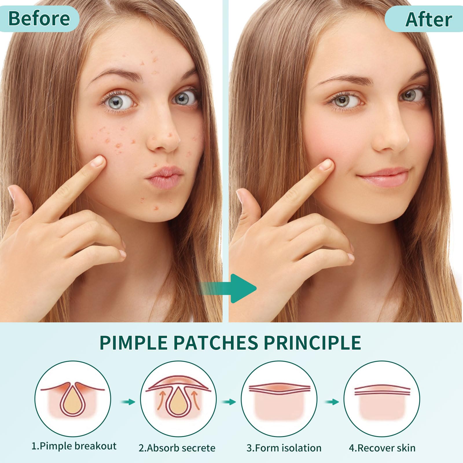 360 Pièces Patch Boutons Acne, 3 Tailles Pimple Patch Star Avec L'huile Tea Tree L'acide Salicylique, Invisibles et Hydrocolloïdes, Imperméables et Respirants, Patchs Étoile pour Jour et Nuit