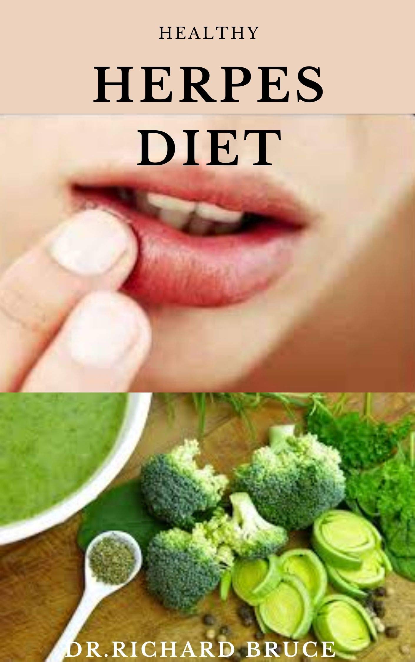 Buy Y HERPES DIET tional Guide On Getting Rid Of Herpes Includes Meal