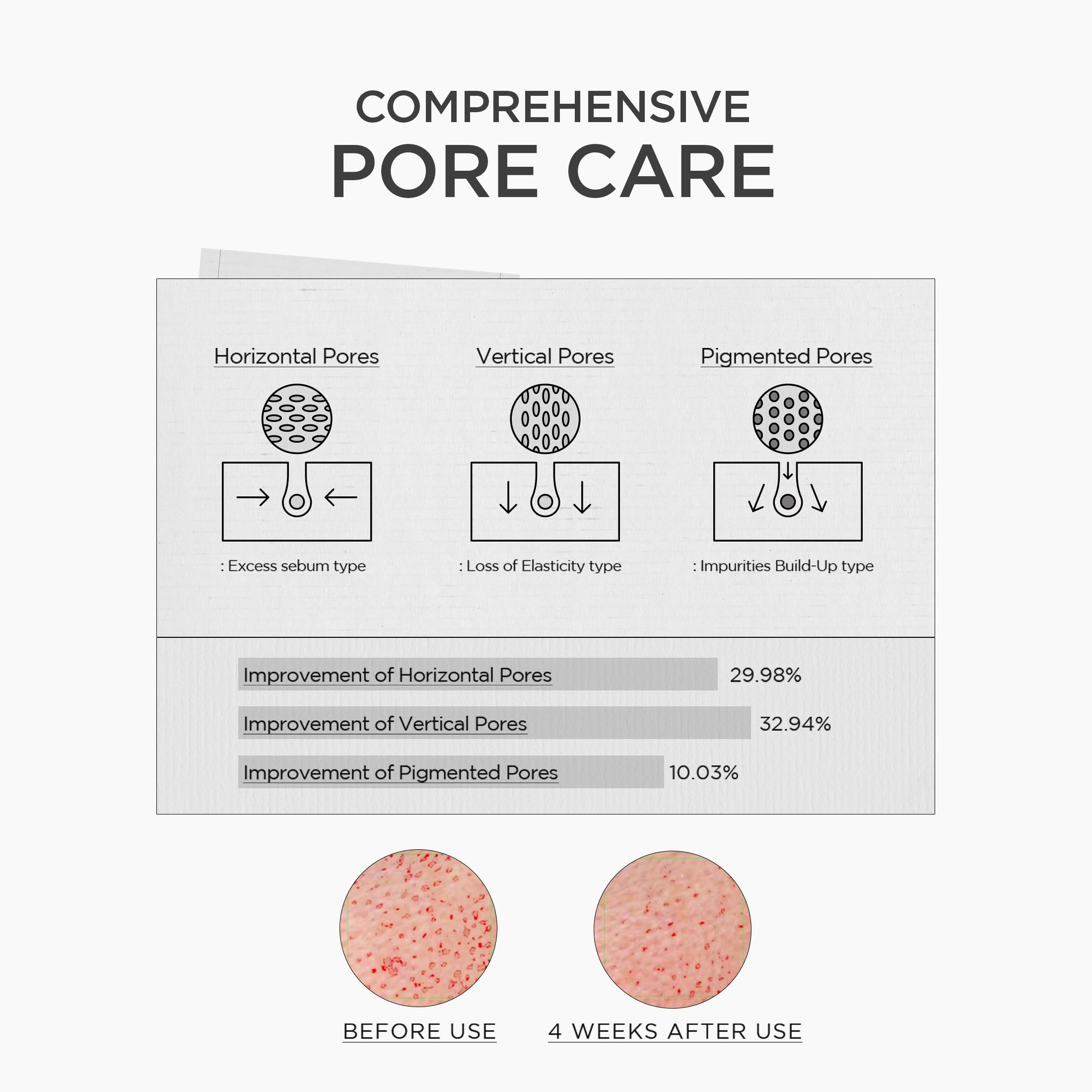SKIN1004 Madagascar Centella Niacinamide 10% Boosting Shot Bulbe, 30 ml
