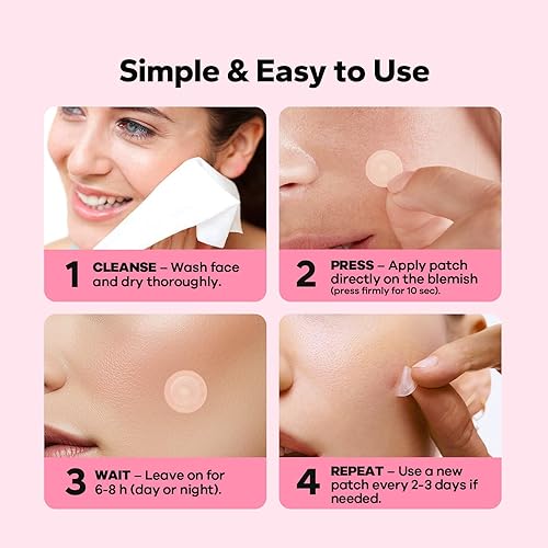 Miniatura 6 de CharmCherry Parches para espinillas para la cara (18 unidades), parches para el acné Microdart, parches hidrocoloides para manchas con ácido