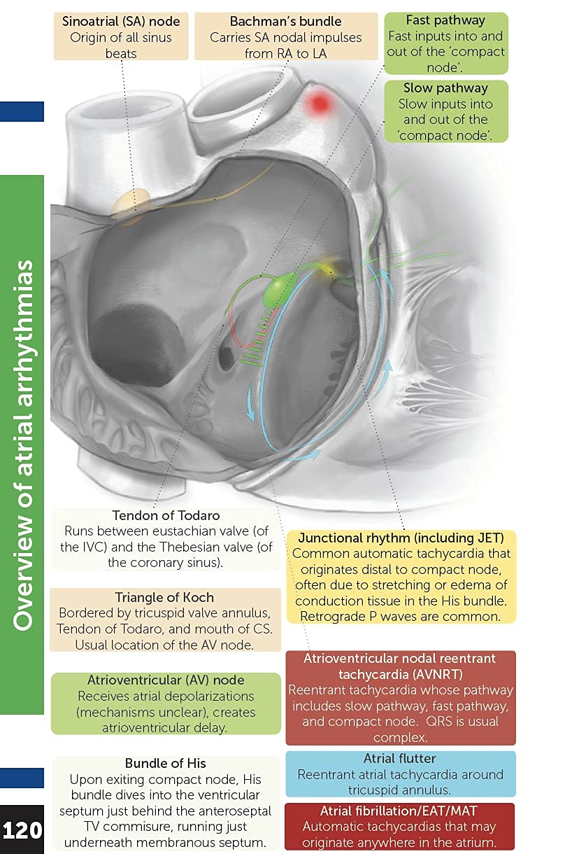 Boston Children's Hospital Cardiac ICU Manual For Bedside Providers - an illustrated handbook of congenital heart disease      Spiral-bound – January 1, 2021