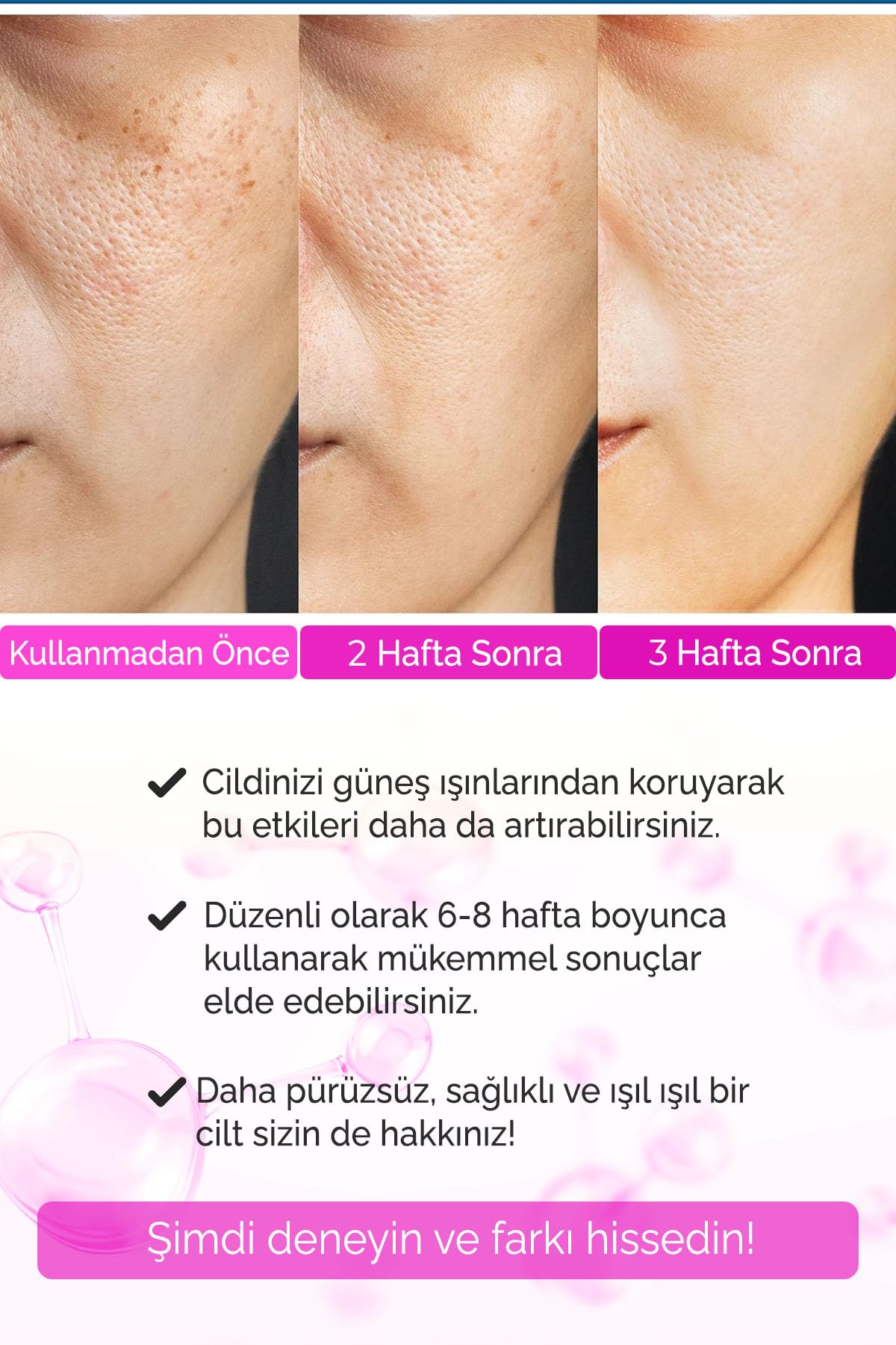 Sivilce Karşıtı Siyah Nokta,Akne Giderici Sérum Elixir Series A260