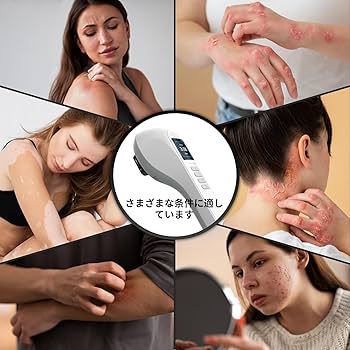 Amazon | エキシマライト光線 308エキシマーシステム 家庭用エキシマー