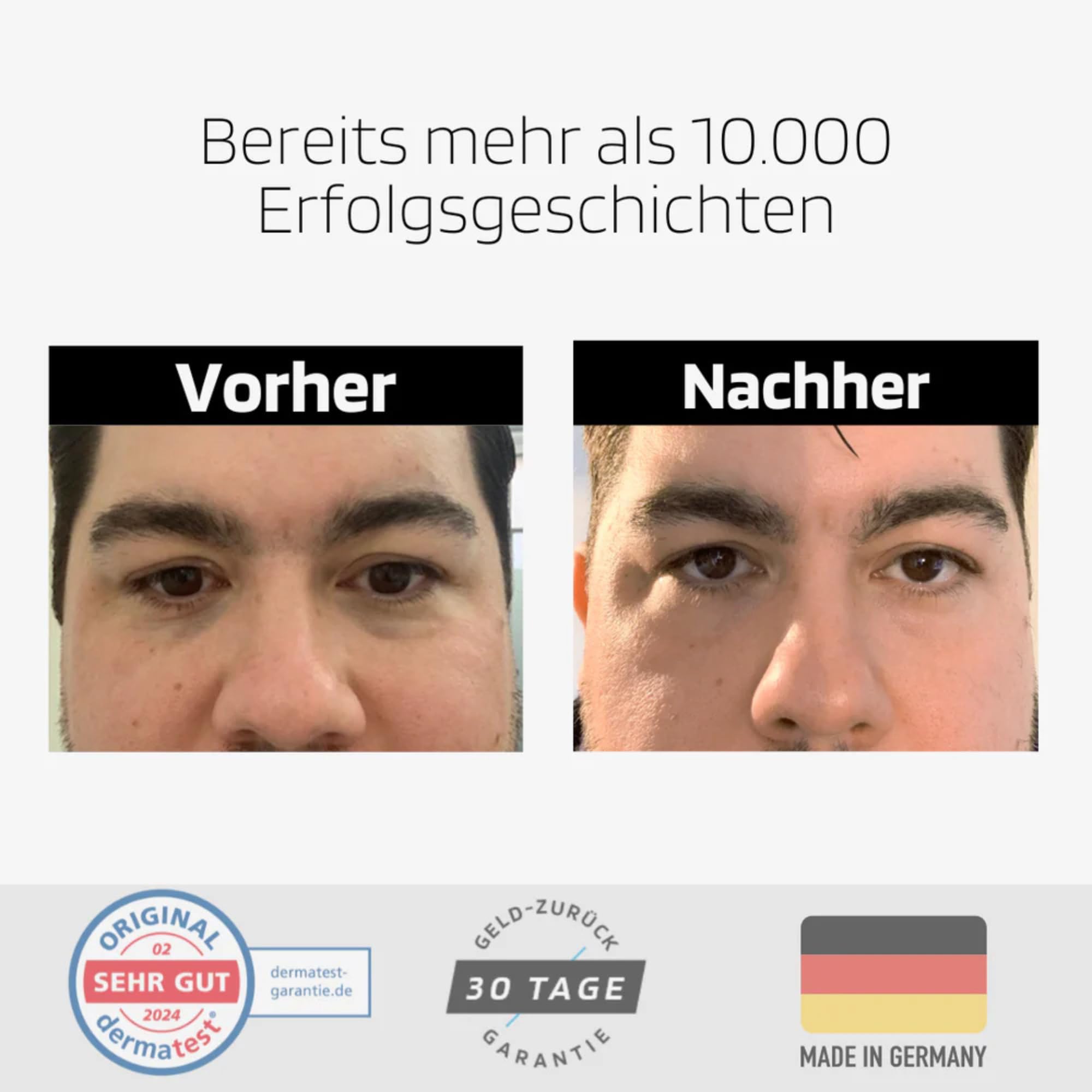 SKINBRO Crema per gli occhi contro rughe e occhiaie per uomini e donne con effetto immediato – Made in Germany – Eye Cream Dermatest molto buona – Crema anti-occhiaie, rimozione delle occhiaie –