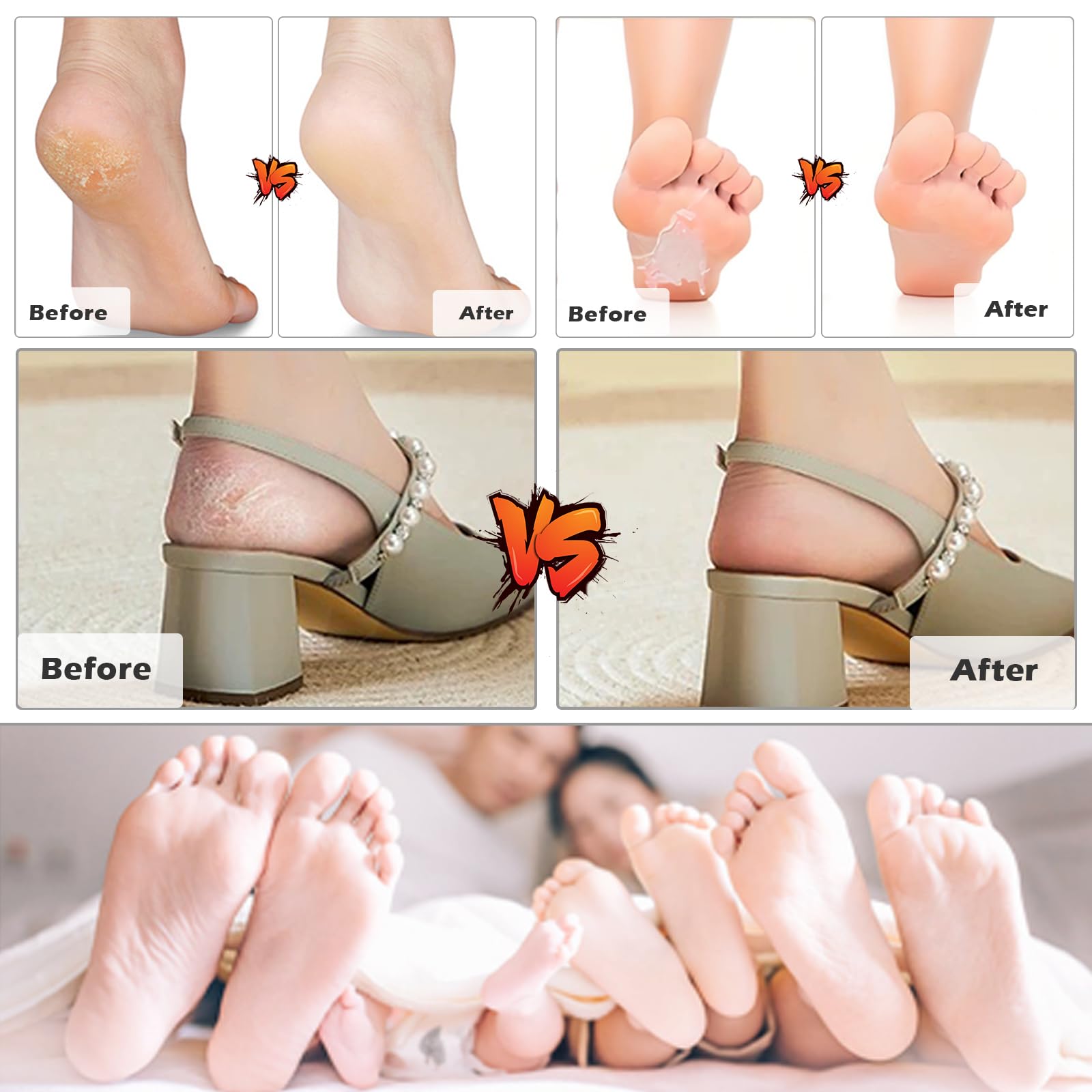 Lima de pie de acero inoxidable (1 unidad) de doble cara, removedor de callos, herramientas profesionales de pedicura, limpiador de pies, removedor de piel muerta, raspador de talón para