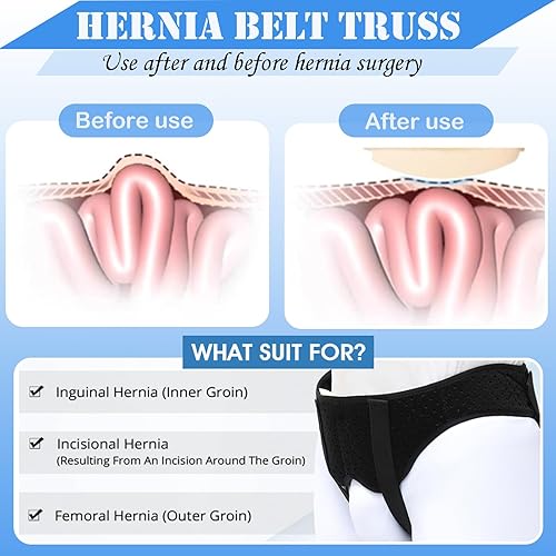 Miniatura 2 de Cinturón de hernia para hombres y mujeres, correa de cintura ajustable con 2 almohadillas de compresión extraíbles, braguero de soporte de hernia