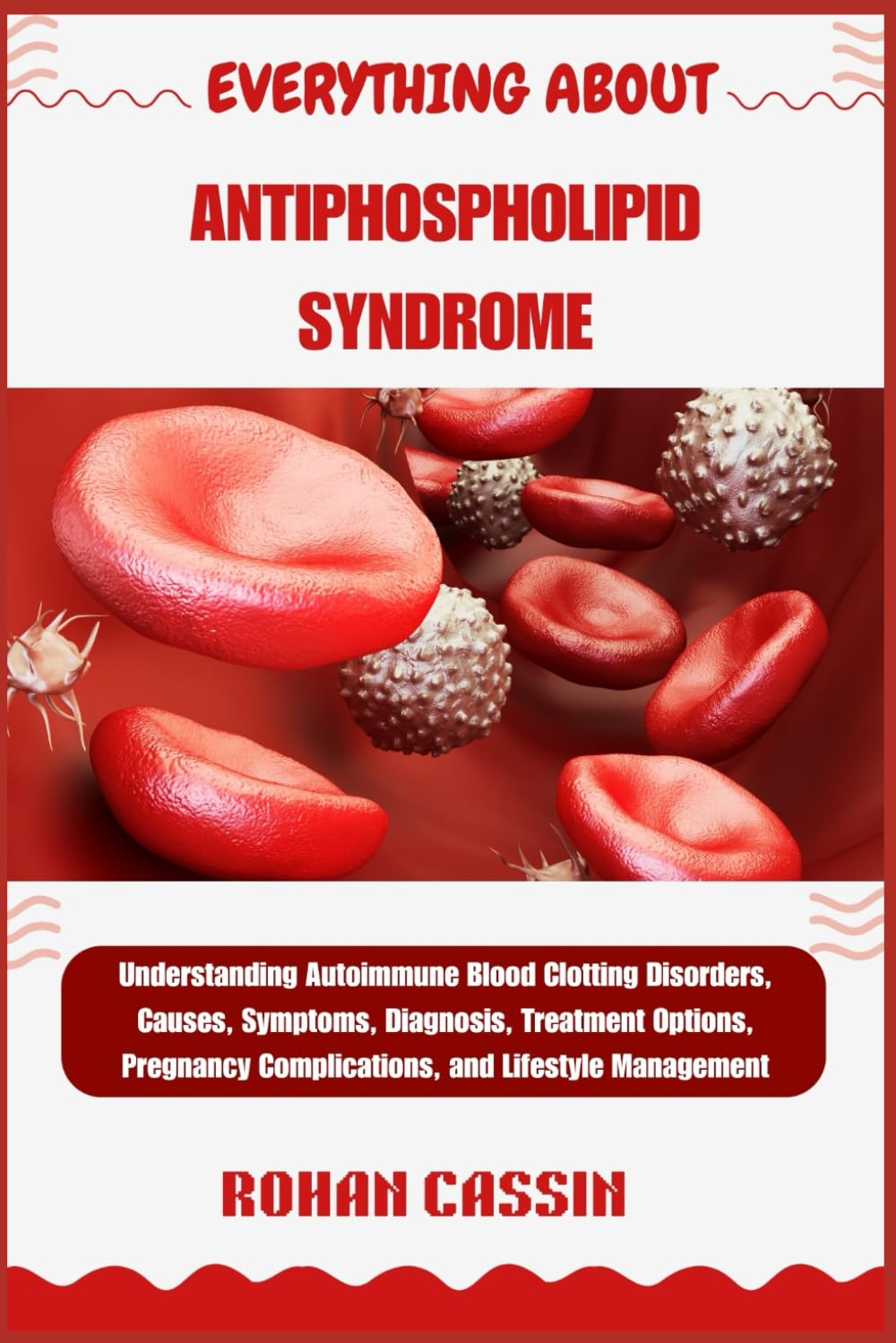 EVERYTHING ABOUT ANTIPHOSPHOLIPID SYNDROME: Understanding Autoimmune Blood Clotting Disorders, Causes, Symptoms, Diagnosis, Treatment Options, Pregnancy Complications, and Lifestyle Management
