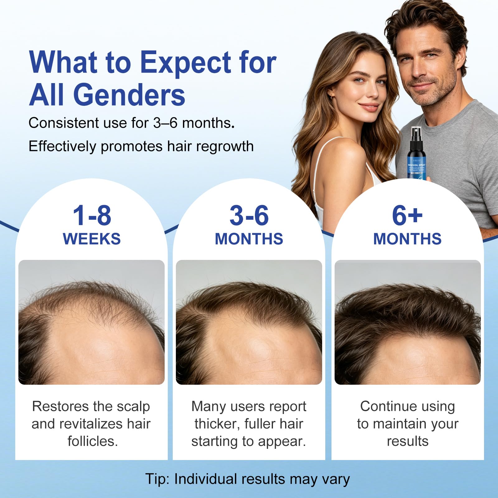 AGIKENB 5% Minoxidil Hair & Beard Growth Spray with Biotin, 8 Pack