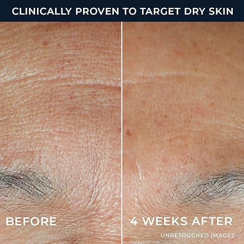 Miniatura 2 de RoC Hidratación+ Suero de Ácido Hialurónico para la Cara, Hidratante, Relleno, Sin Fragancia, Fórmula Ligera con Proteínas de Colágeno (1 Onza) con