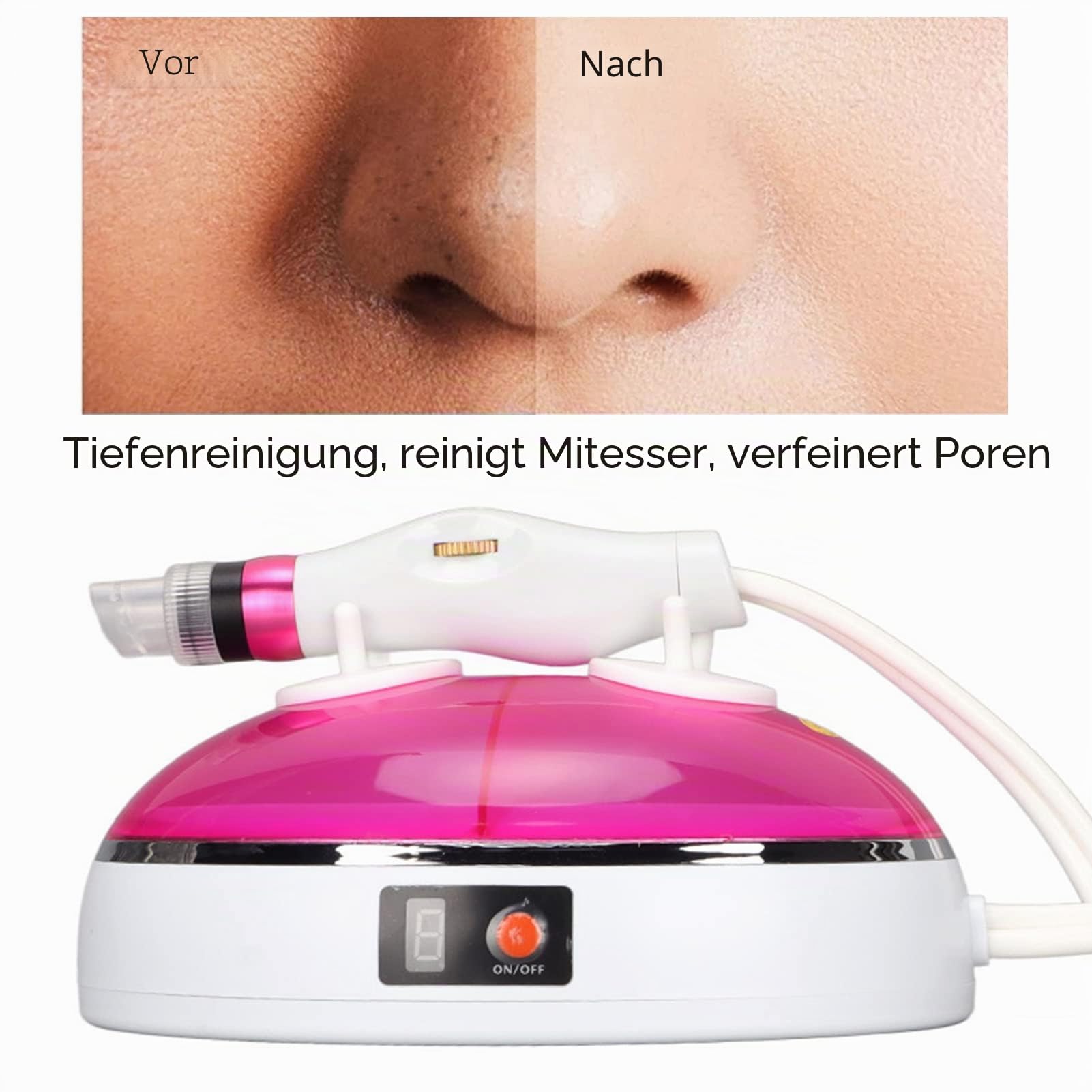 Mitesser-Entferner, Porenstaubsauger, 3 Saugstärken, 8 Sonden, wiederaufladbares USB-Mitesser-Staubsauger-Set, Gesichtsporenreiniger, elektrisches Extraktionswerkzeug für Frauen