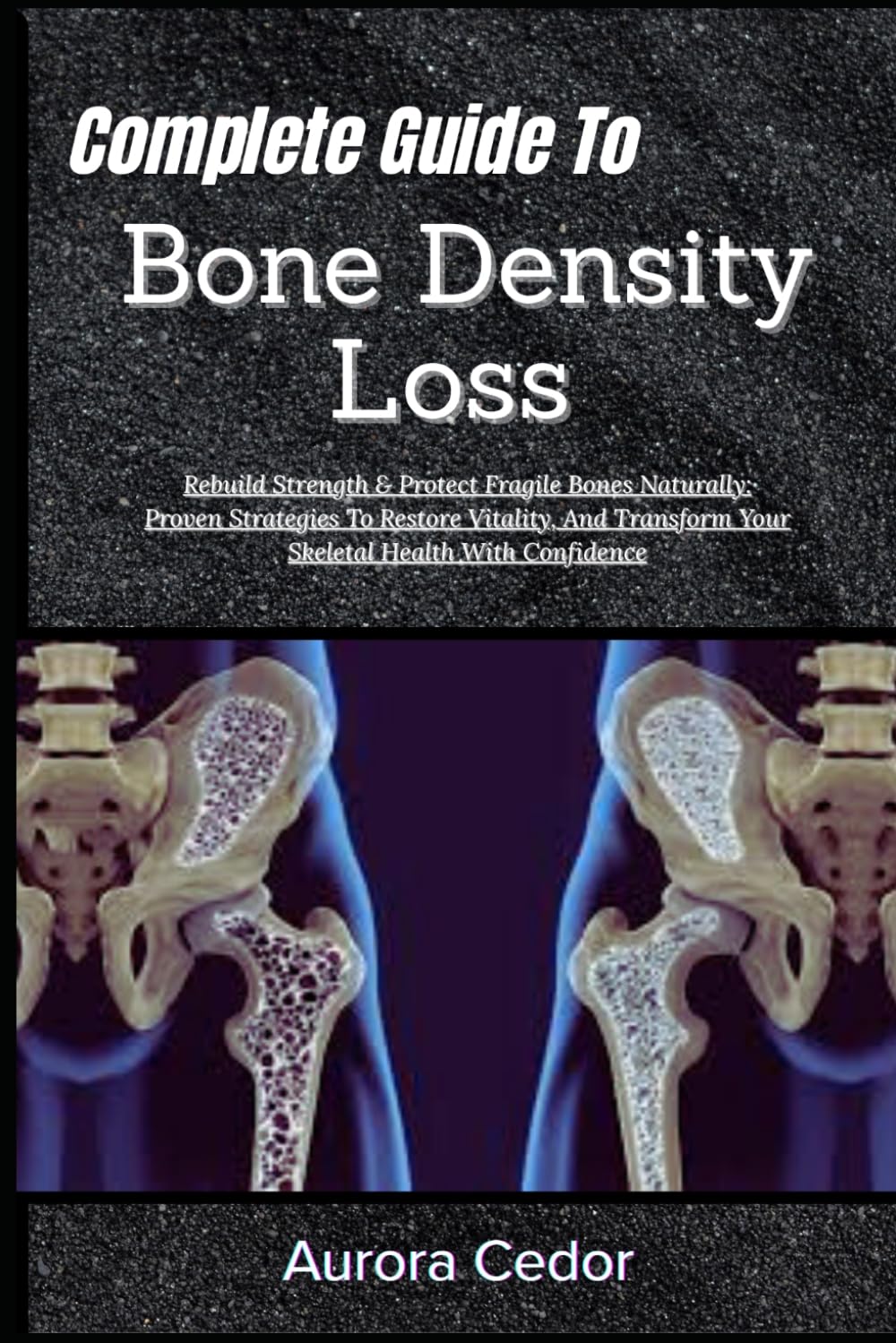 Complete Guide To Bone Density Loss: Rebuild Strength & Protect Fragile Bones Naturally: Proven Strategies To Restore Vitality, And Transform Your Skeletal Health With Confidence