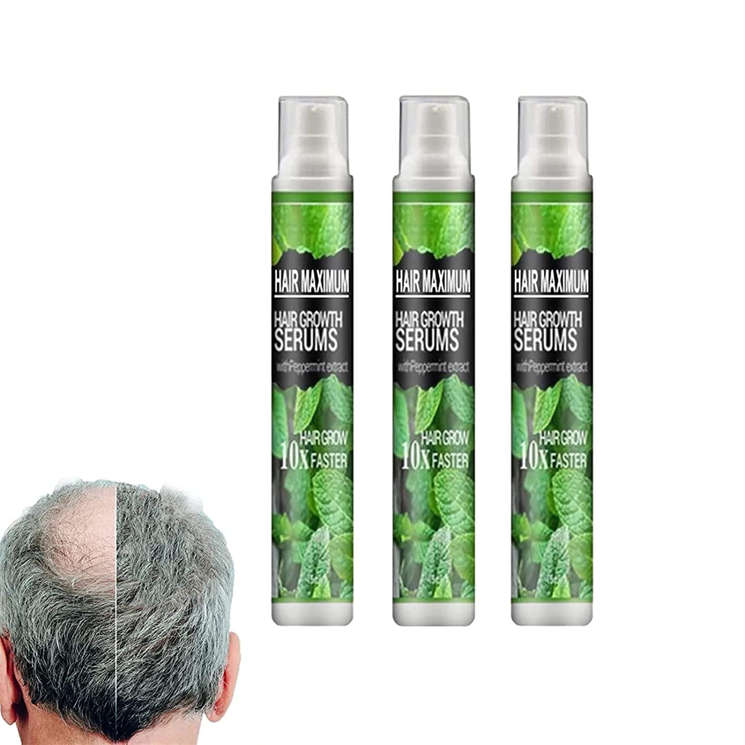 Herbal Hair-Growth Essence Spray,Serum Anti Hair Loss Fast Grow Prevent Hair Dry, Prevent Postpartum Hair Loss Hairlines Herbal Hair Essence Spray (3 Pcs)