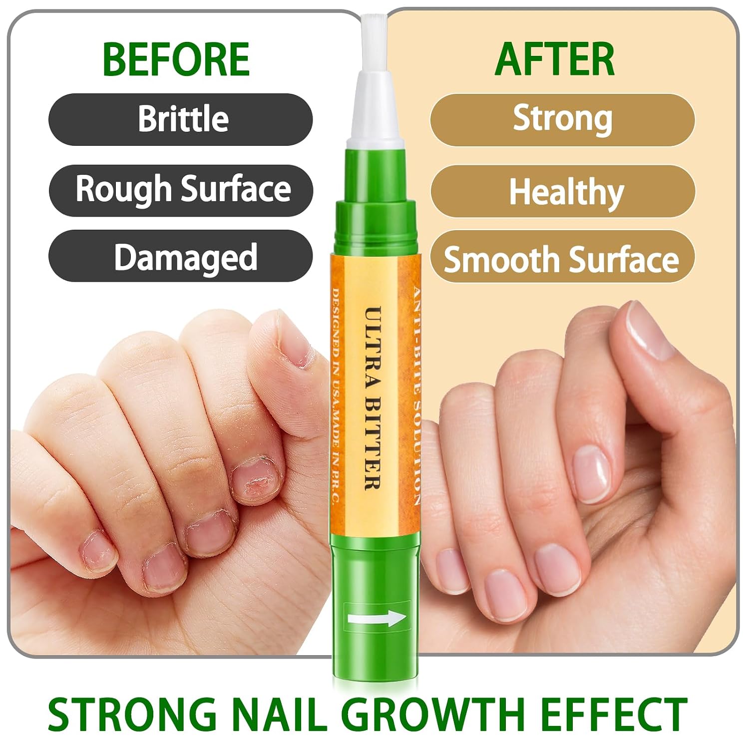 3 IN 1 Nail Biting Prevention Kit for Kids & Adults -3 Pack Includes Extra Strength+ Gentle Bitter Polish + Cuticle Oil. Fast Drying Formula Stops Nail Biting & Thumb Sucking