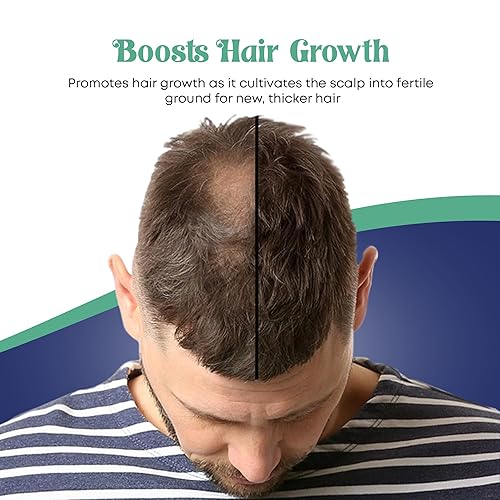 Miniatura 8 de Let-It-Grow Champú 16oz