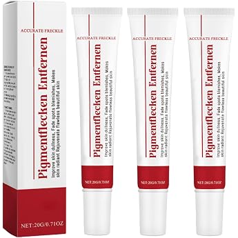 Pigment Spot Remover Face Whitening Cream with Vitamin C Cream Against Pigment Spots Dark Spots Melasma and Age Spots Suitable for All Skin Types 3