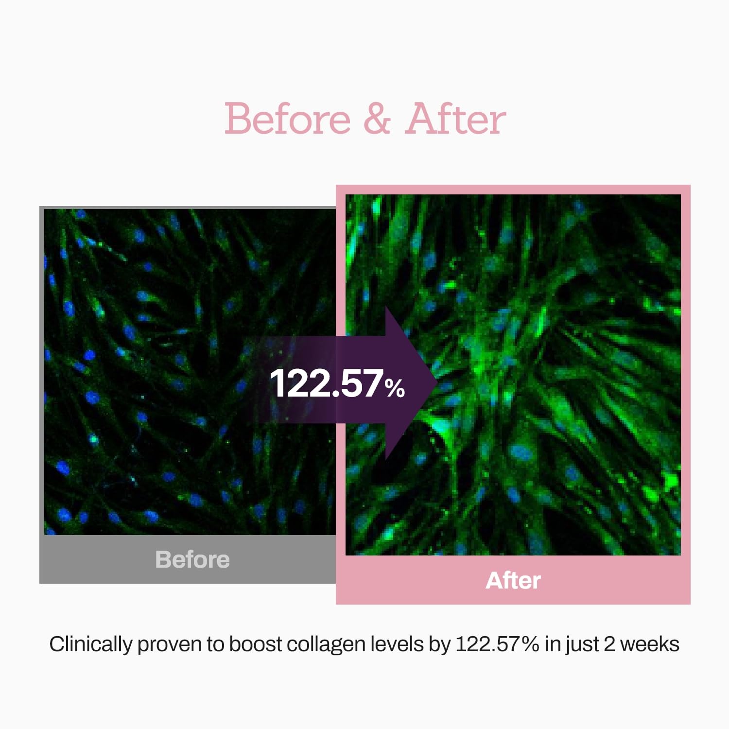 Collagen Peptide 12X Boosting Serum, Enhances Skin Elasticity & Reduces Deep Wrinkles, Promotes Collagen Production for Firm and Youthful Skin, Korean Skincare, 1.01 fl.oz - Image 5