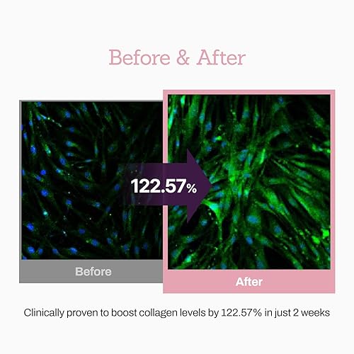 Miniatura 5 de Suero potenciador de péptido de colágeno 12X, mejora la elasticidad de la piel y reduce las arrugas profundas, promueve la producción de colágeno