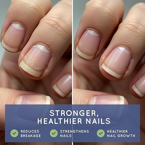 Miniatura 4 de Essential Source Biotin (Biotina Vitaminas) - Vitaminas para el cabello y la piel de las uñas para mujeres y hombres - 5000 mcg - Suplementos para