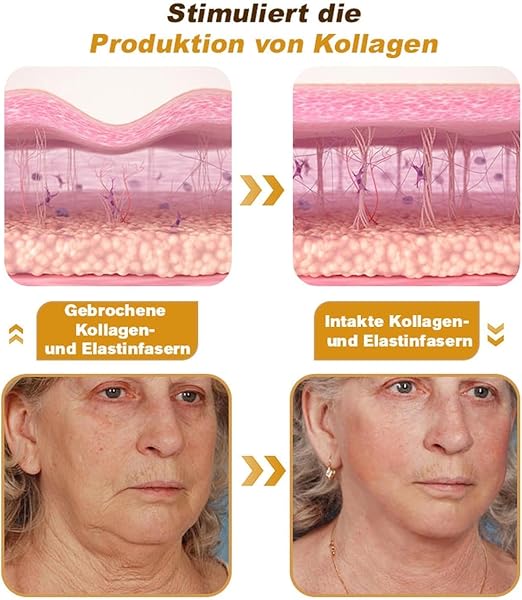 Furzero Bienenvenom Faltenentfernungscreme, Bienengift Faltencreme, Professional Bienengift Anti-Falten-Creme, Bienengift-Faltenentfernungscreme, Bienengiftsalbe für alle Hauttypen (2 schachtel) - 4