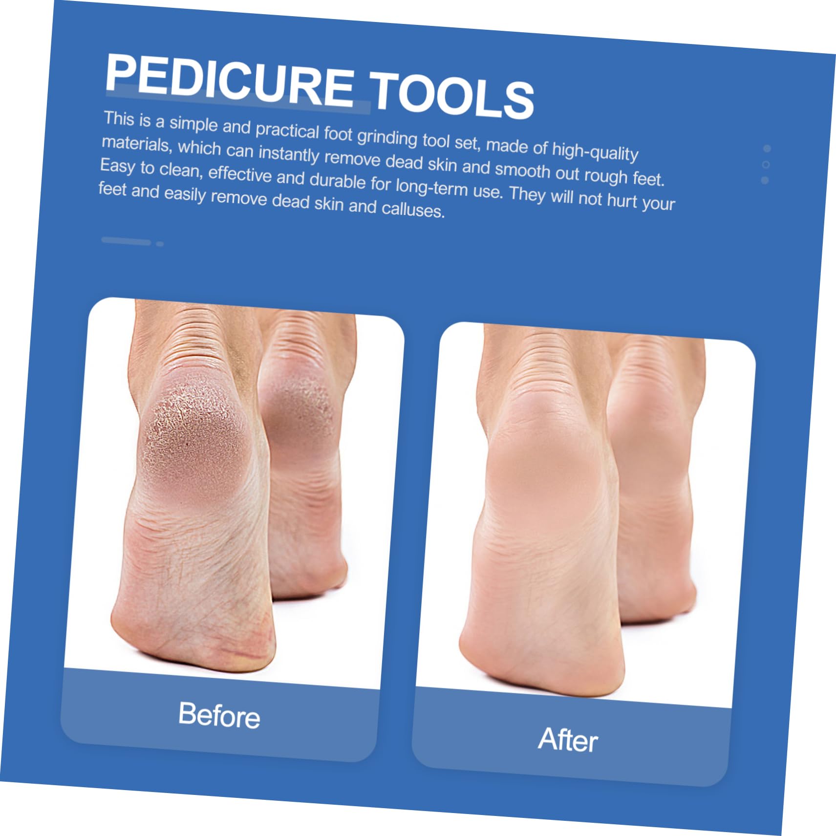Didiseaon Kit per Pedicure in Acciaio ad Alto Manganese 7 Pezzi Coltelli per Rimuovere Calli ed Esfoliare Pelle Secca, Set Completo per Uso Professionale e Familiare
