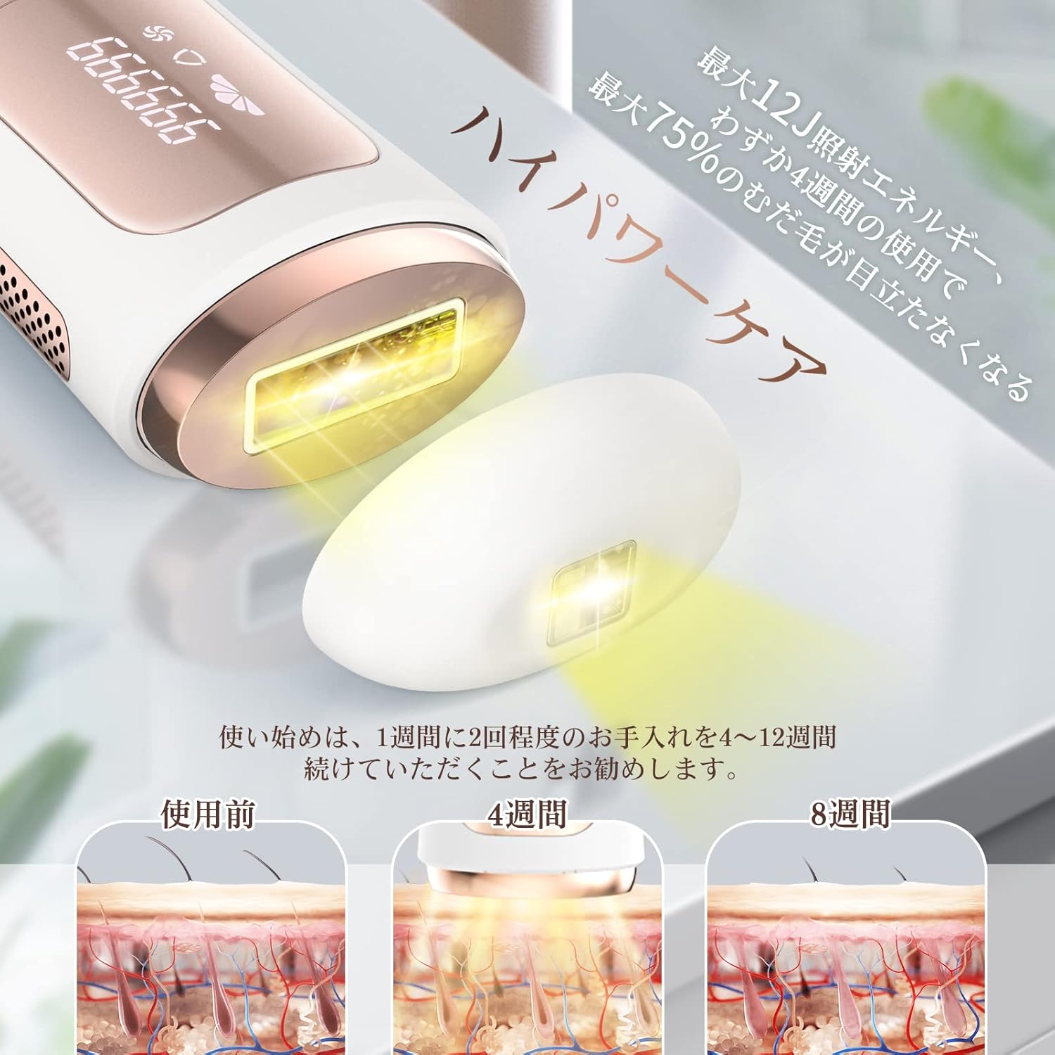 ANLAN IPL Hair Removal Device showing hair reduction over 4 and 8 weeks.