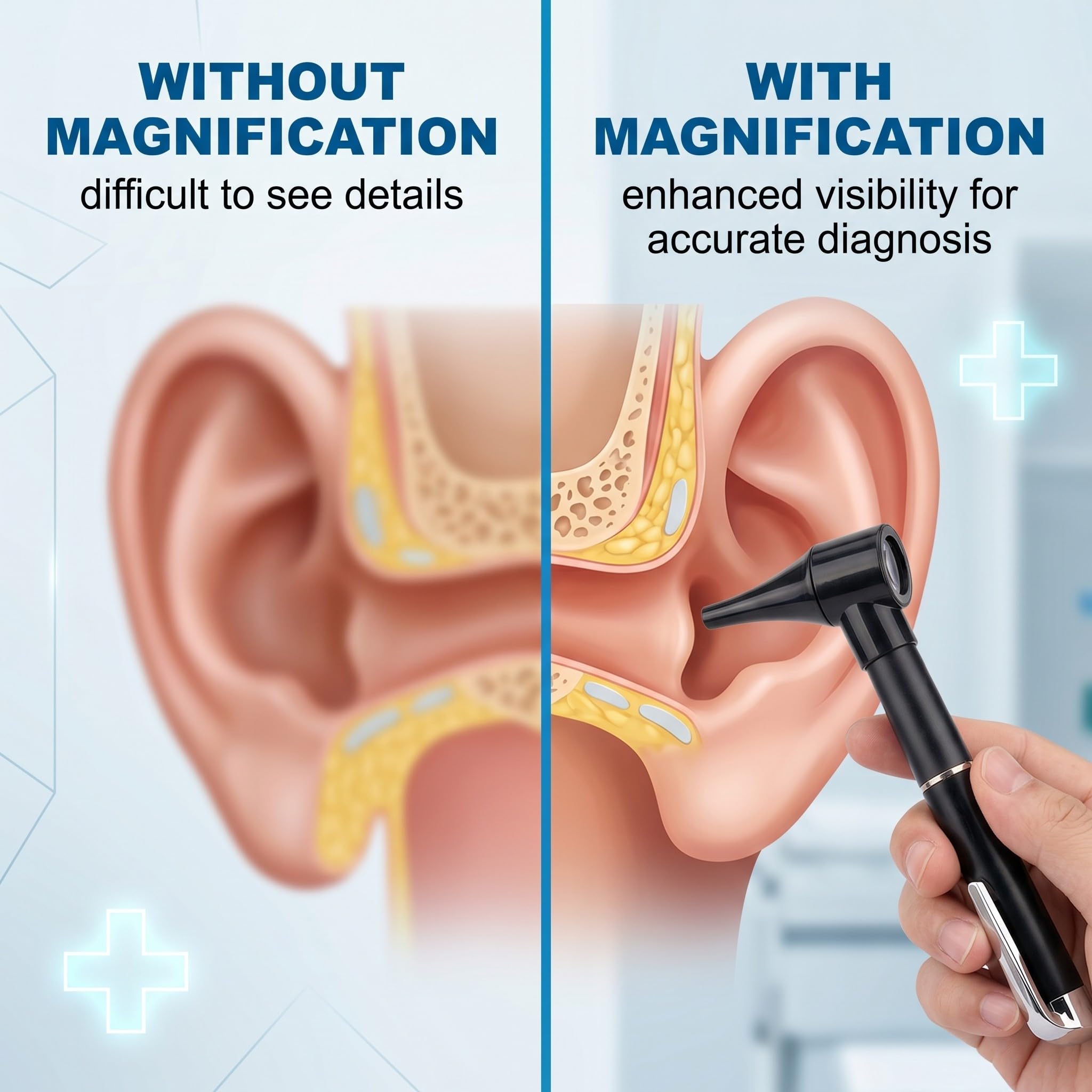 Mini Otoscope Oreille avec Grossissement et Lumière LED, Kit de Diagnostic Médical avec 5 Spéculums Auriculaires Interchangeables