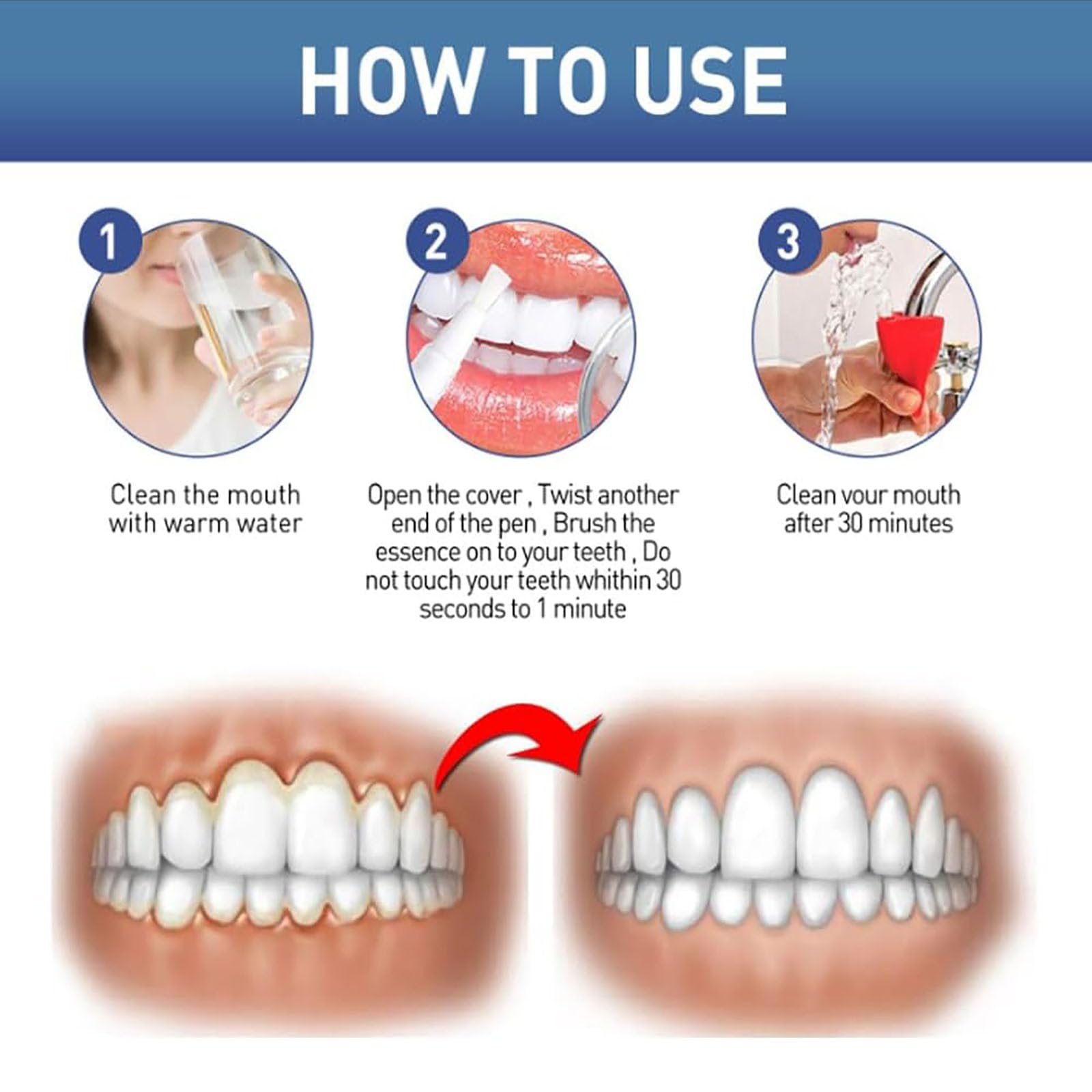 Gel pour les gencives GumEase, Gel réparateur dentaire Gum Ease, Gels apaisant instantané pour les gencives, Stylo réparateur d'essence pour les dents, Haleine fraîche (3Pcs)