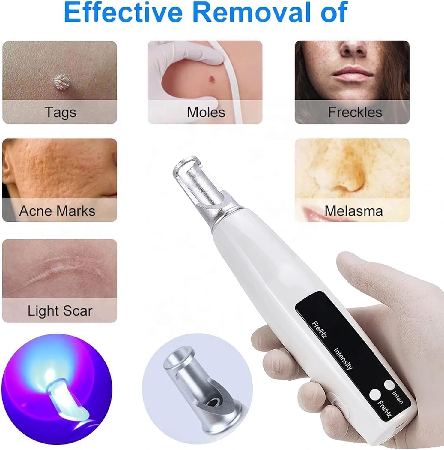 Stylo d'élimination des taches, stylo d'élimination des taches à pois pour enlever les tatouages cicatrices, 9 niveaux de fréquence et 4 niveaux d'intensité, Blue Light
