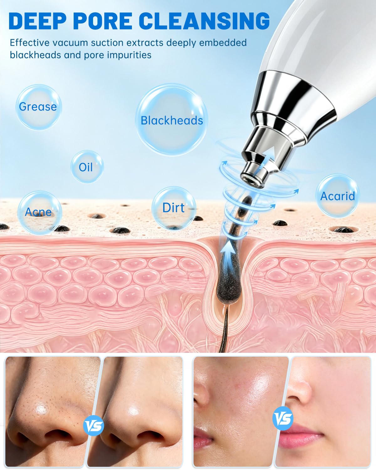 Mikrodermabrasionsgerät mit 9 Diamantaufsätzen, 7 Stufe, Tragbare Dermabrasion Maschine für Gesichtspeeling, Porenreinigung & Hautpflege Zuhause