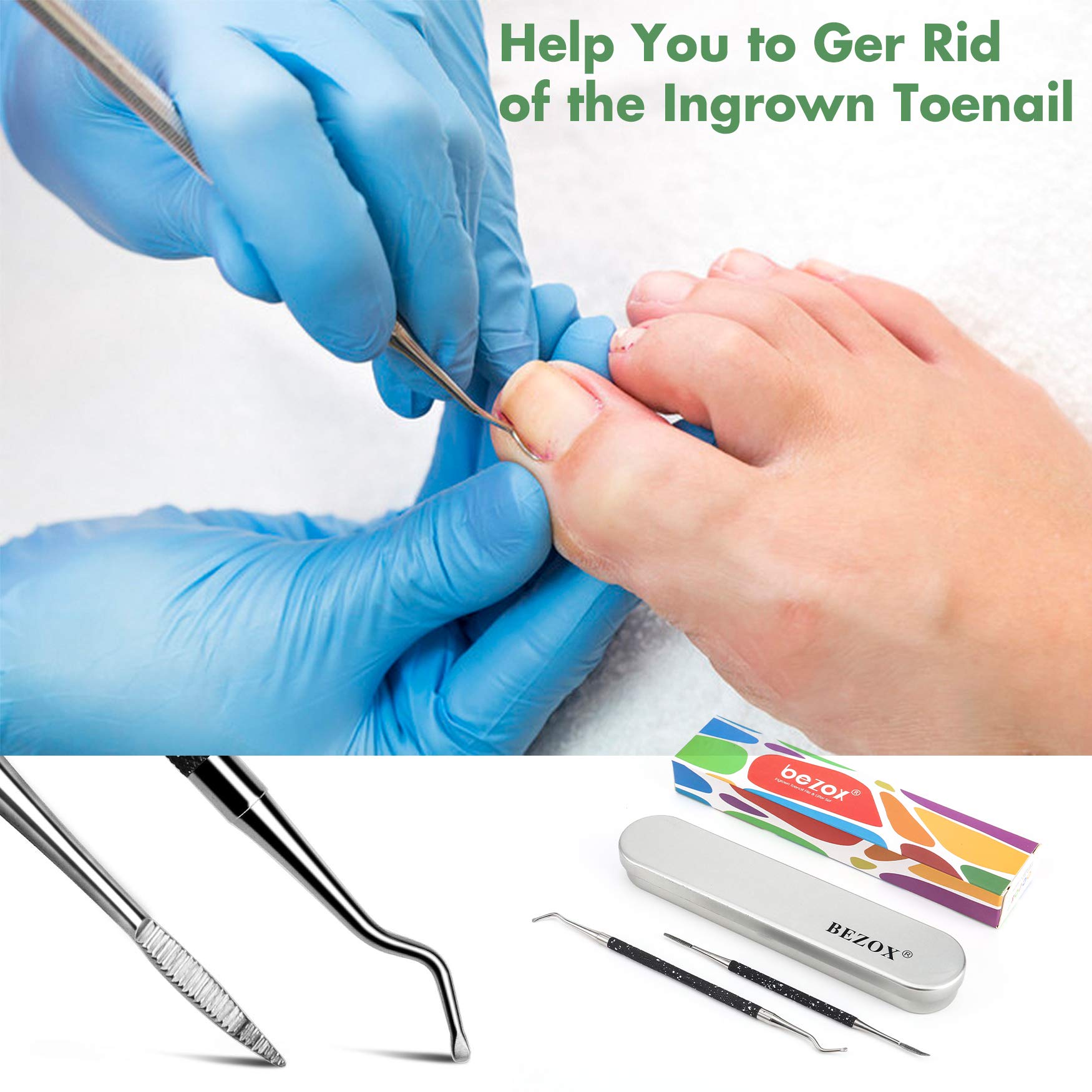 BEZOX Ingrown Toenail File & Lifter Set Podiatrist Preferred Ingrown
