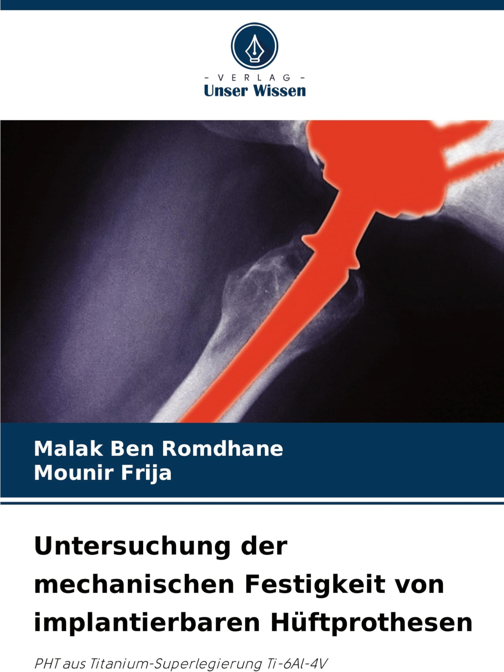 Untersuchung der mechanischen Festigkeit von implantierbaren Hüftprothesen: PHT aus Titanium-Superlegierung Ti-6Al-4V