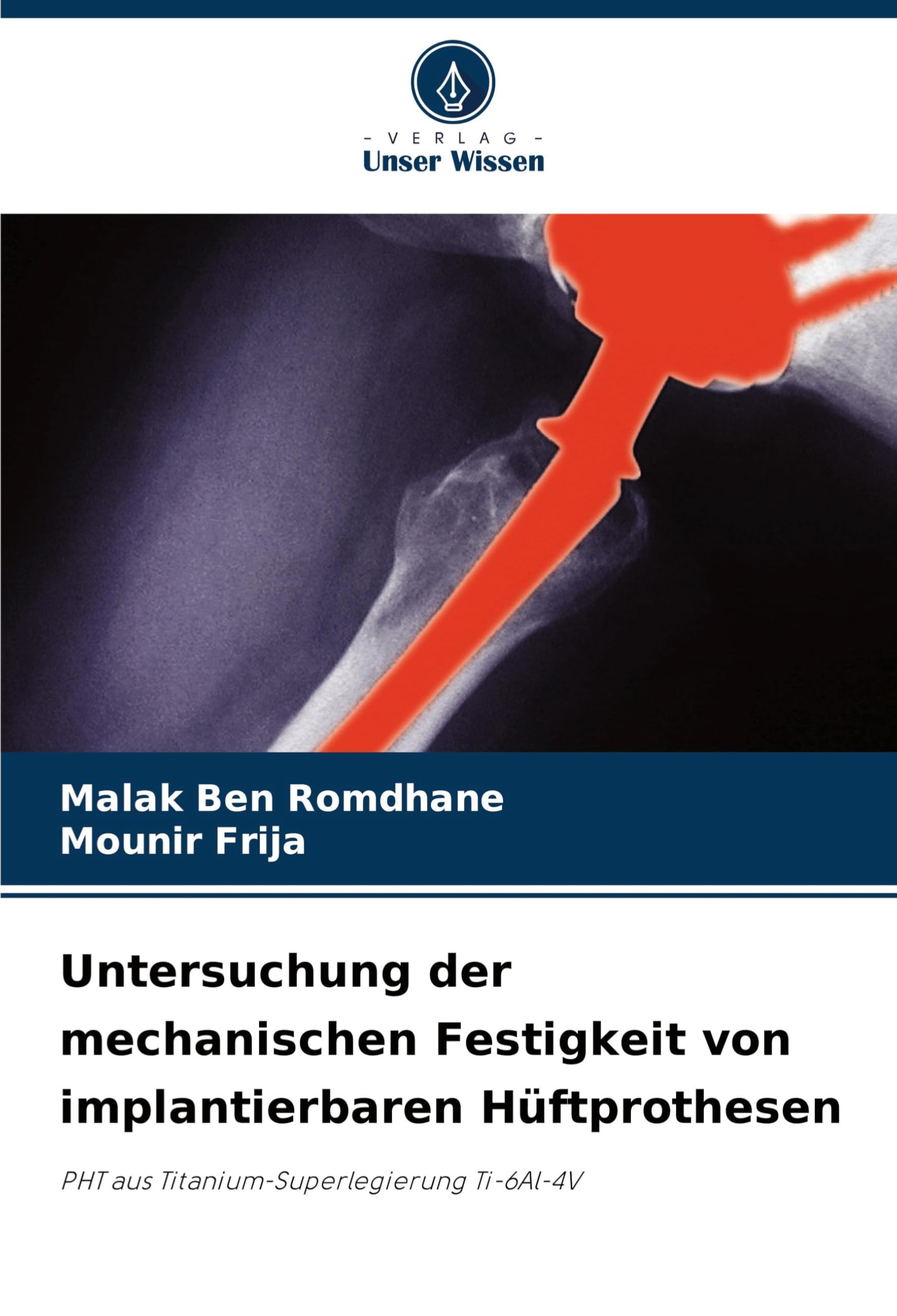 Untersuchung der mechanischen Festigkeit von implantierbaren Hüftprothesen: PHT aus Titanium-Superlegierung Ti-6Al-4V
