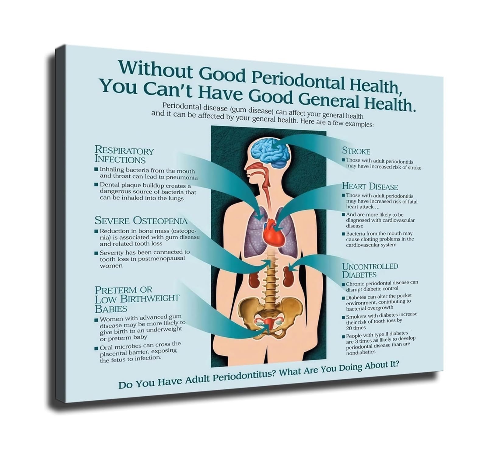 IDGTTLDF Educational Infographic Poster Oral Health Relationship to Health Chart for Waiting Room Clinic and Hospital Decor Unframed,16X24inch(40X60cm)