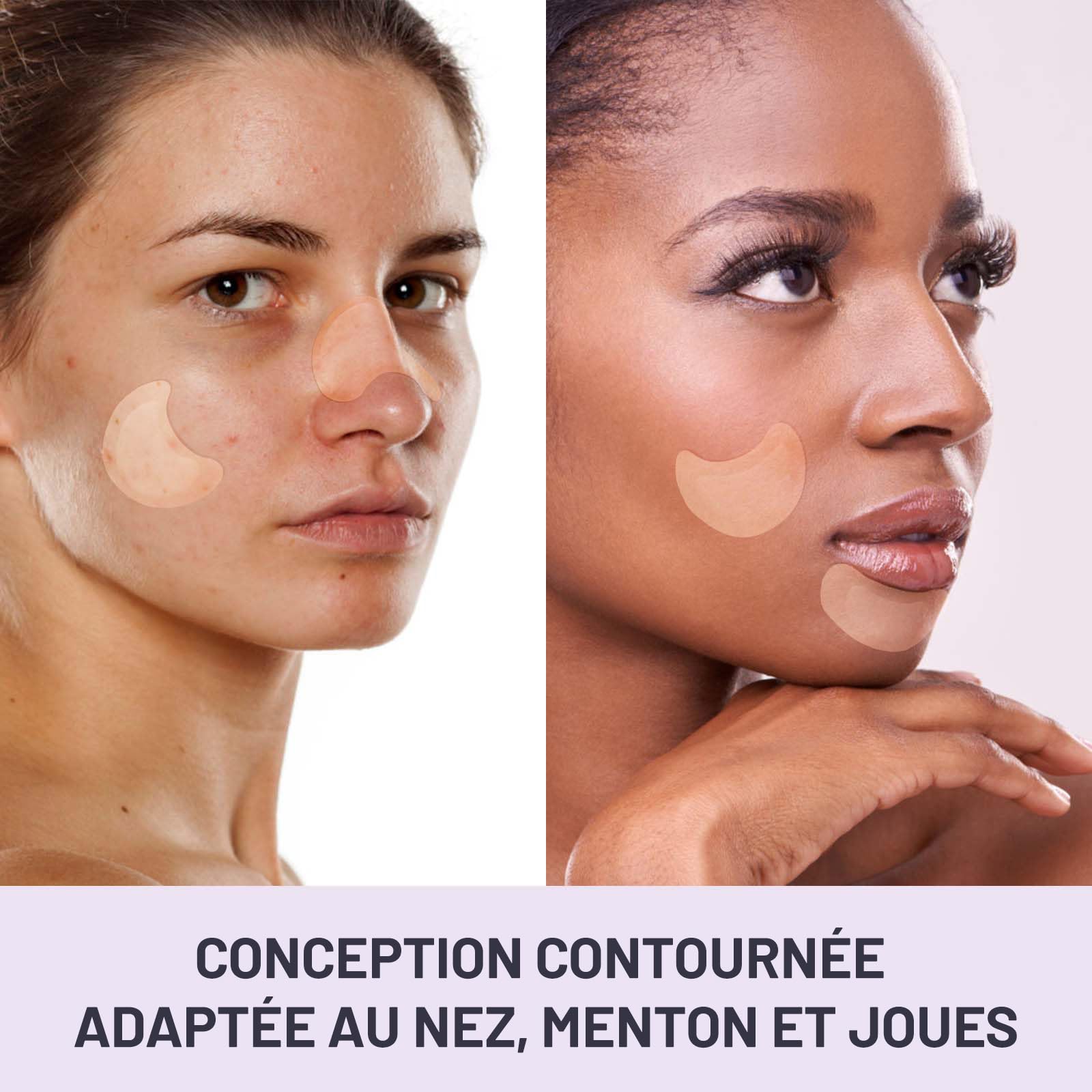 Patchs bouton ACOTYE 32pcs, pimple patch à L'huile d'arbre à thé, acide salicylique à et niacinamide, pour sur le menton, les joues, le dos