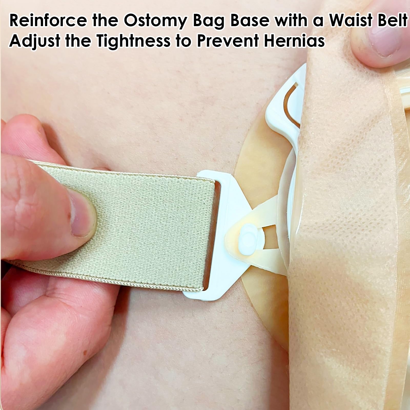 15 Suministros para Ostomía, Bolsas de Colostomía de Dos Piezas, Bolsa de Ostomía Drenable para Ileostomía y Cuidado del Estoma, Recortables a Medida de 15-60 mm (10 Bolsas + 5 Barreras)