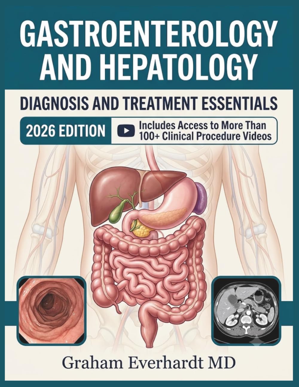 GASTROENTEROLOGY AND HEPATOLOGY DIAGNOSIS AND TREATMENT ESSENTIALS: A Clinical Guide to GI and Liver Disease, Workups, and Management