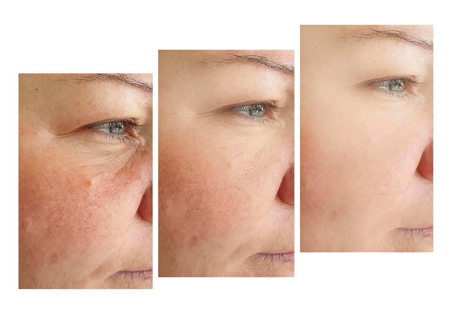 VITALITY PRECISION SKIN Clear Defense SPF 45 - Image 5