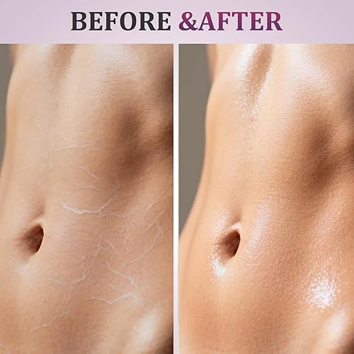 Miniatura 2 de Aceite reafirmante corporal de 2 piezas, hidratación de absorción rápida para apretar y reafirmar brazos, pecho, muslos, enriquecido con vitamina E,