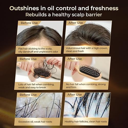 Miniatura 3 de Champú anticaída de cabello, cuidado del cuero cabelludo con botánicos naturales, tratamiento de terapia del cuero cabelludo para hombres y mujeres,