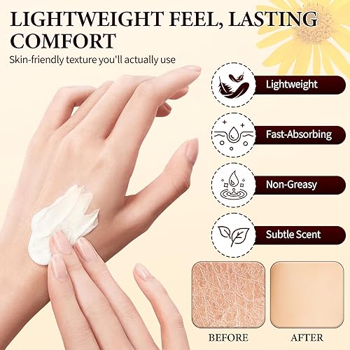 Miniatura 3 de 2 unidades de crema nerviosa Alcura, loción neuropatía con árnica, calmante natural para articulaciones, nutrición diaria para rodilla, manos, pies