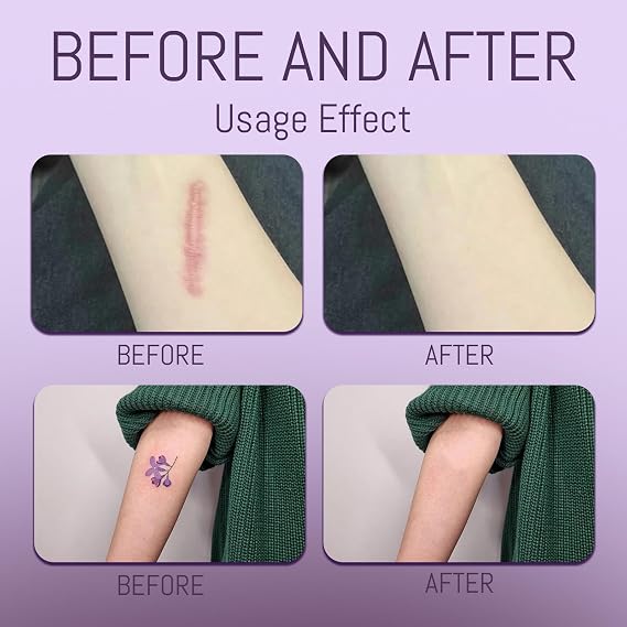 Body Coverage Perfector - Waterproof Body Makeup with Brush & Marshmallow Puff - No Transfer, Full Coverage for Tattoos, Scars, Veins (2.0oz Natural Beige)