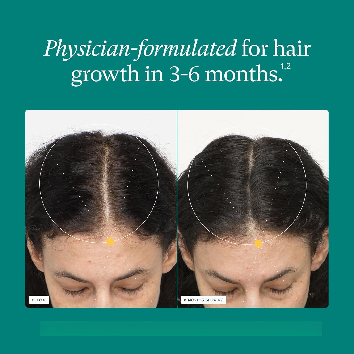 1 pezzo non OGM: i capelli delle donne crescono e diventano più forti