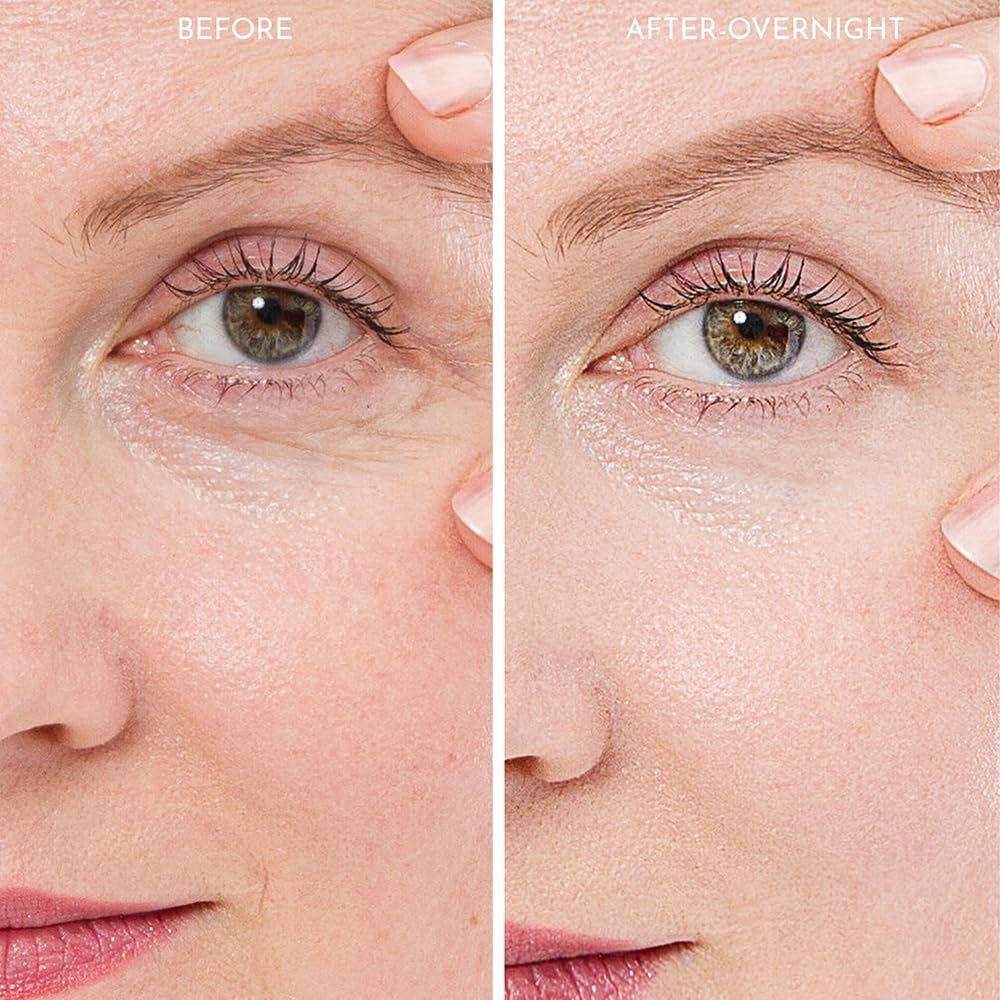 Truly Clear 20X Reusable Expression Line Smoothing, Medical-Grade Silicone for Overnight Wrinkle Reduction & Anti-Aging Hydration, Beautify Brow Lift Forehead Anti-Wrinkle Patch