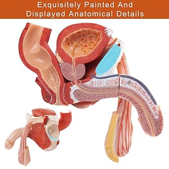 【ラプンツェル様用】ATAVISM / PUTREFIED GENITALIA Traumatophora triscalpta (Martens, 1875). Genitalia
