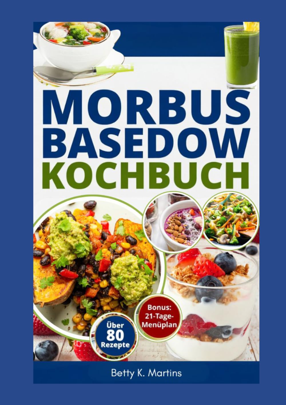 MORBUS BASEDOW KOCHBUCH: Über 80 entzündungshemmende Rezepte zur Linderung von Hyperthyreose-Symptomen und mehr Energie