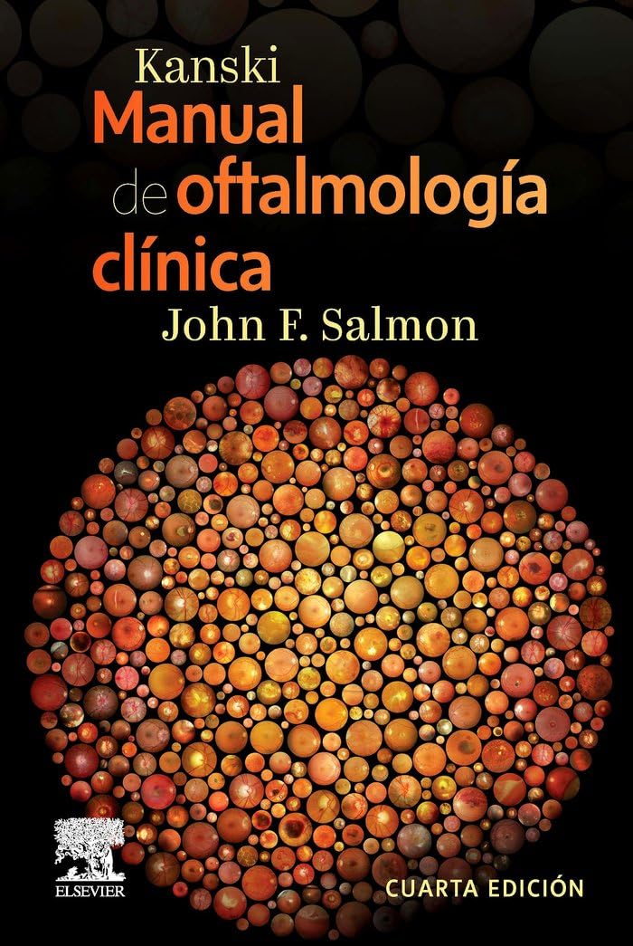Kanski. Manual de oftalmología clínica
