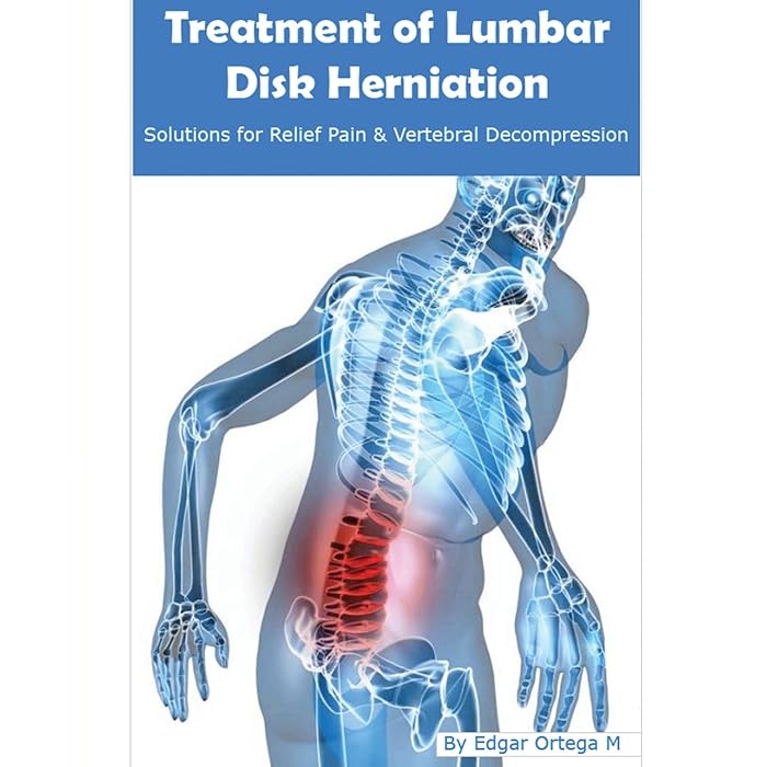 Buy Treatment of Lumbar Disk Herniation Back Pain Relief and Herniated